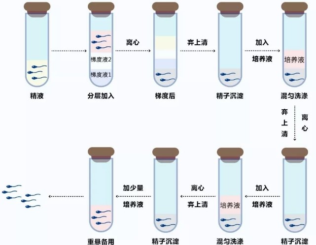 高龄试管用什么方案好