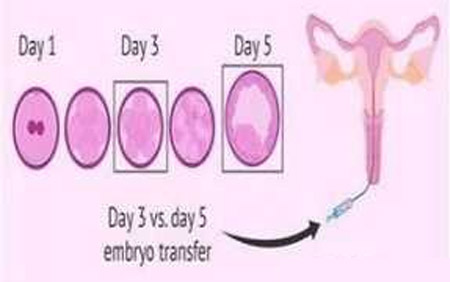 4aa囊胚移植成功经验（4aa囊胚移植几天着床）